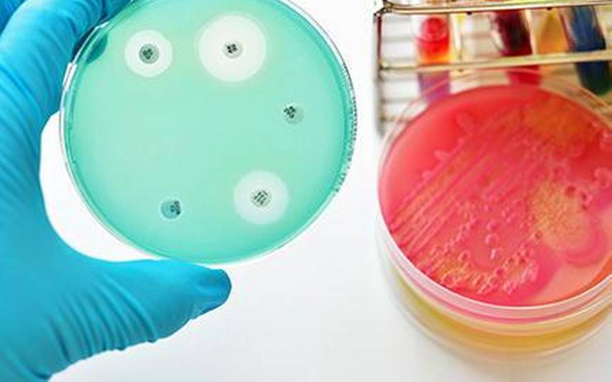The need to combat antimicrobial resistance Laboratory