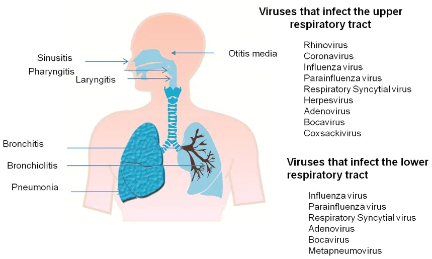 A deeper look at Respiratory tract infections (RTIs)
