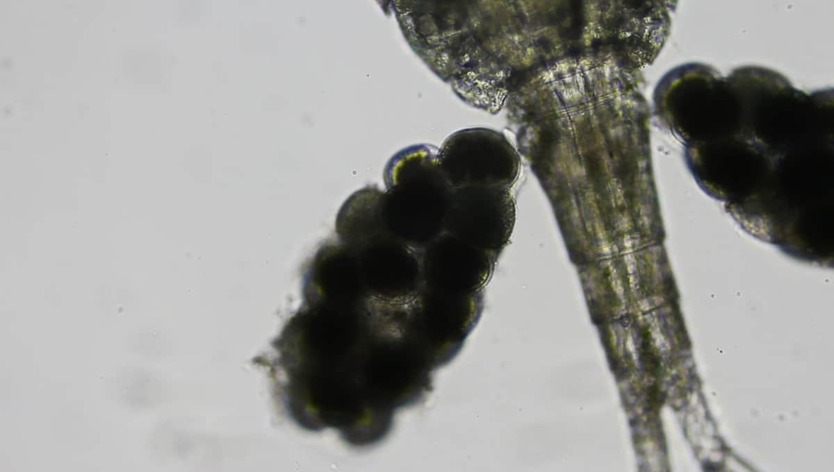 What are Copepods? (Copepods Under a Microscope) Microscope Clarity