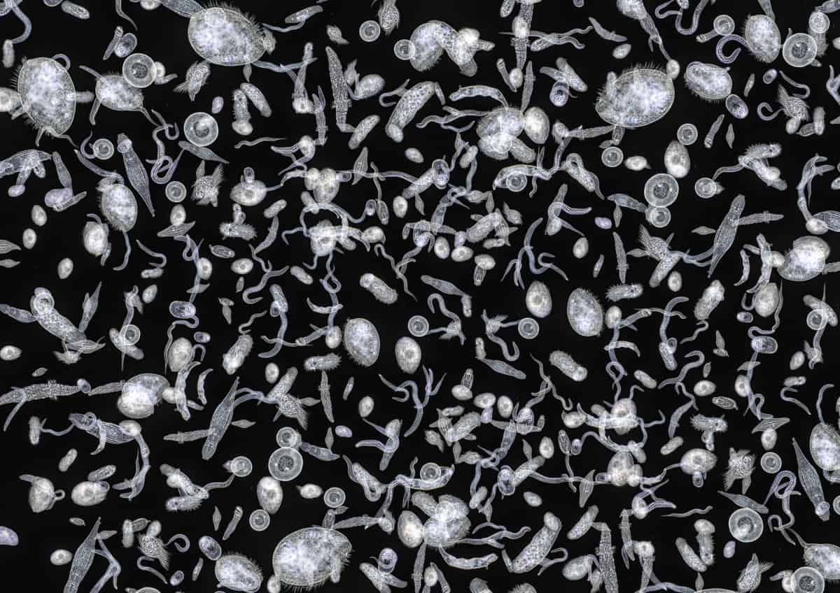 What is Dark Field Microscopy Microscope Clarity