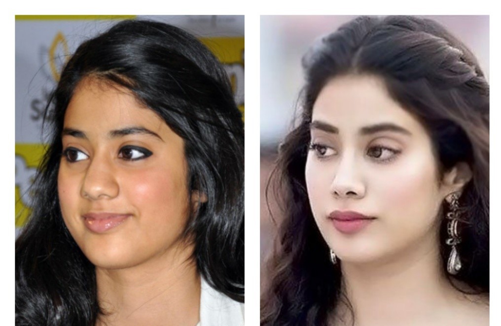 Bollywood celebrities who witnessed drastic changes after surgery