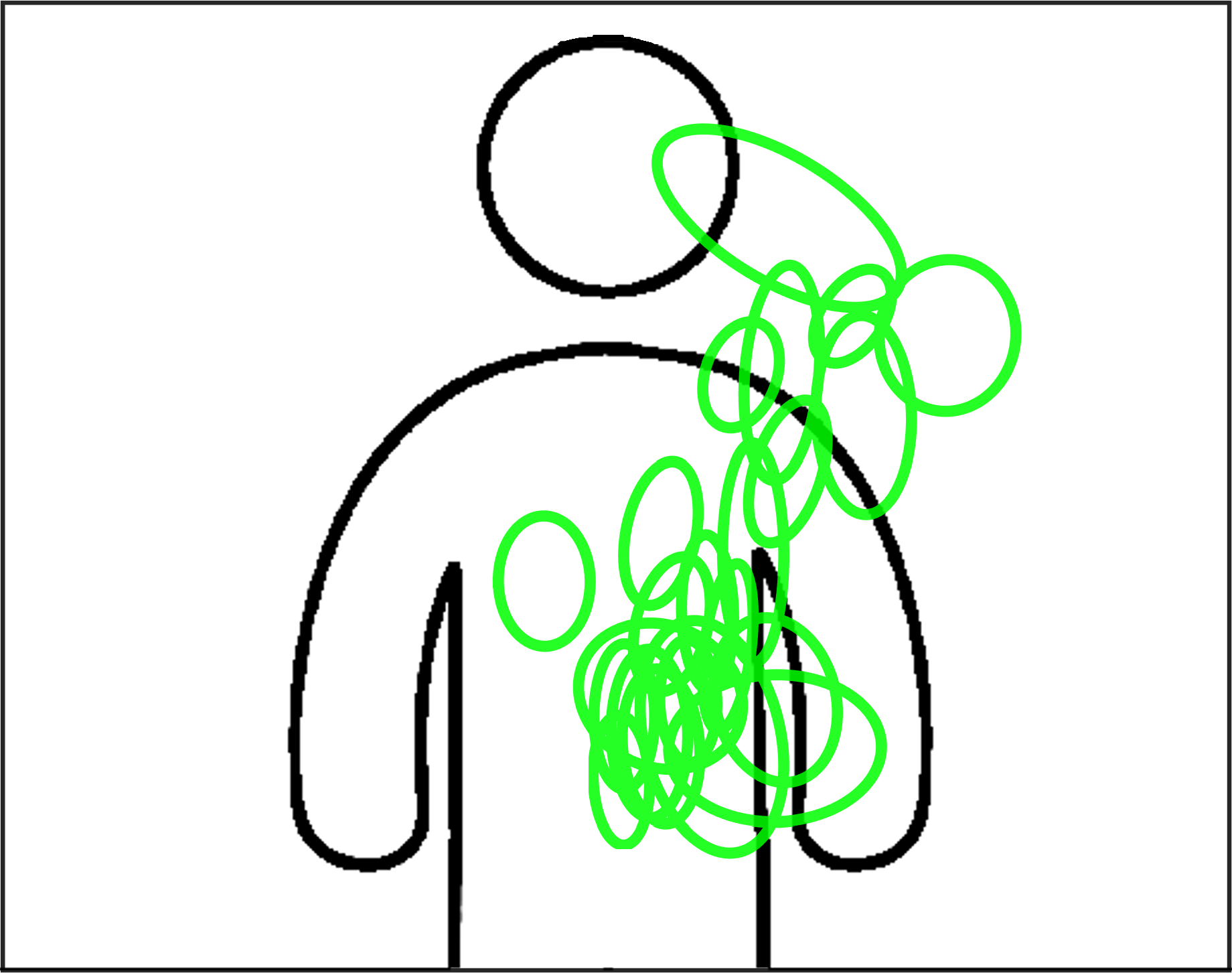 Right hand, initial position Right hand, final position