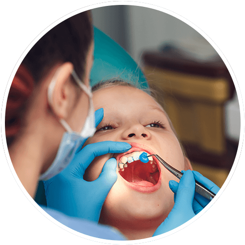 Root Canal Spring Valley Dental Care