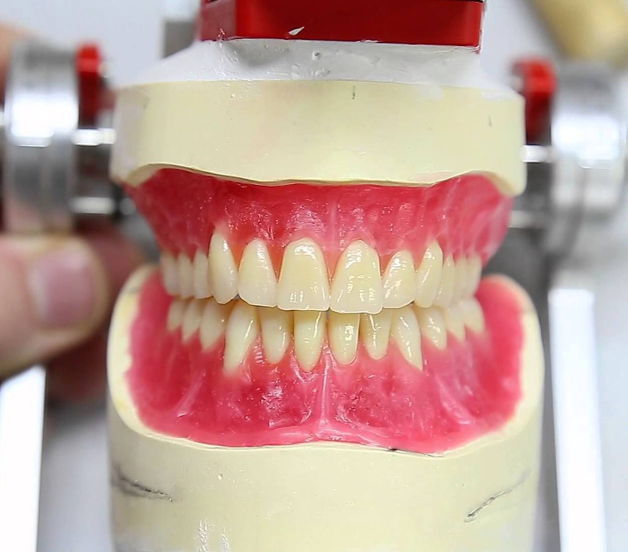 IMMEDIATE DENTURES MIDWEST DENTURES & MOUTHGUARDS