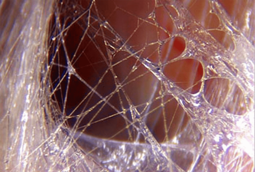 Fascia the missing link to human health and well being MihaPower