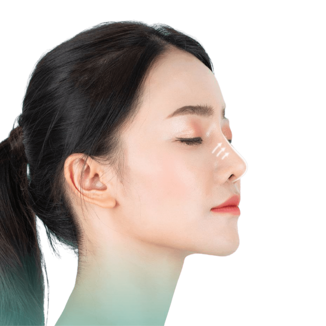 Nose Lift and ReshapingRefining Your Profile