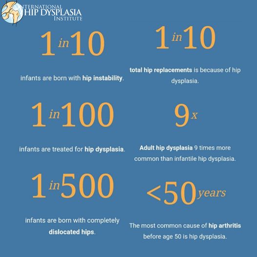 What is Hip Dysplasia? Miles4Hips