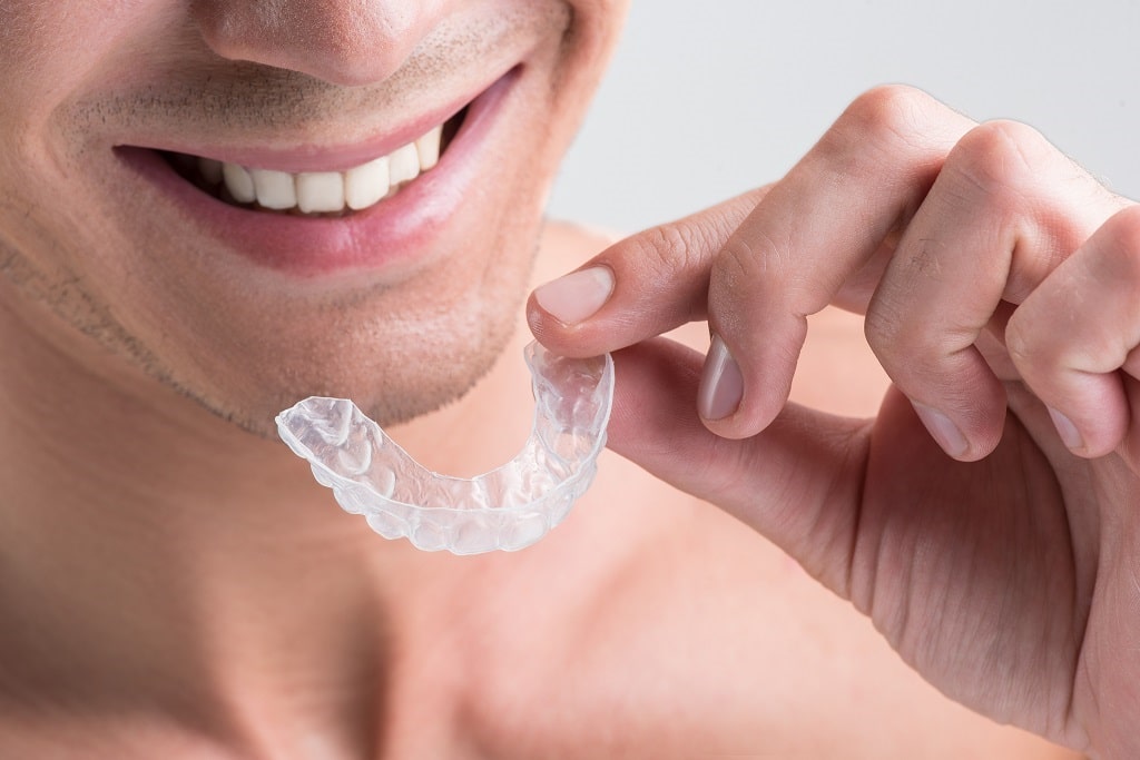 How Long Does Invisalign Take (And Why)? Exactly How Long