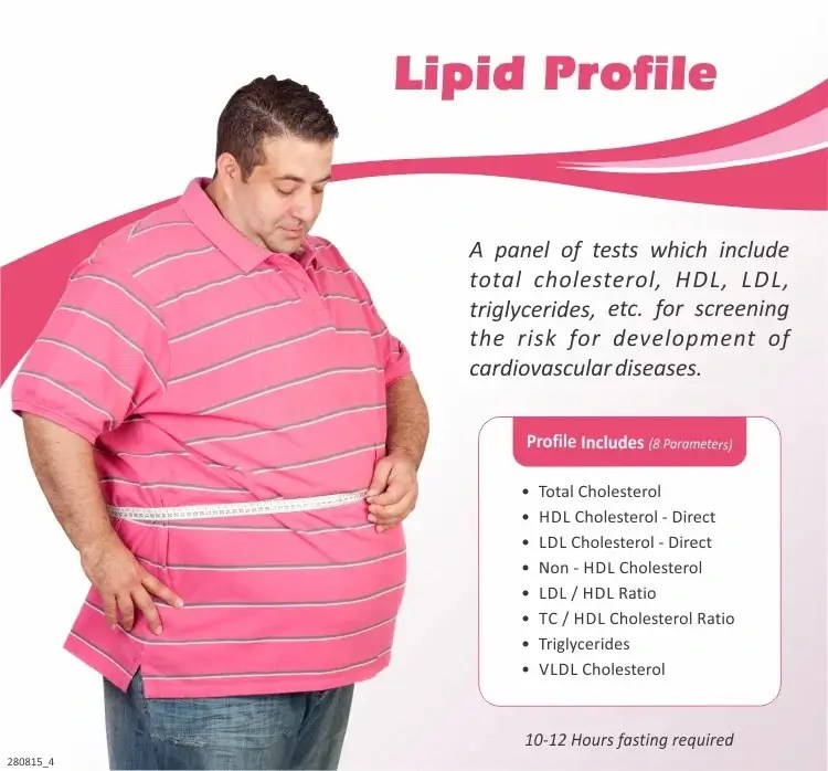 Lipid Profile Test 500/Only Free Home Collection
