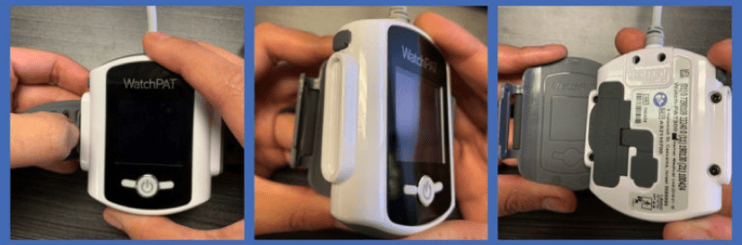 WatchPAT Instructions | Home Sleep Apnea Test | Millennium Sleep Lab