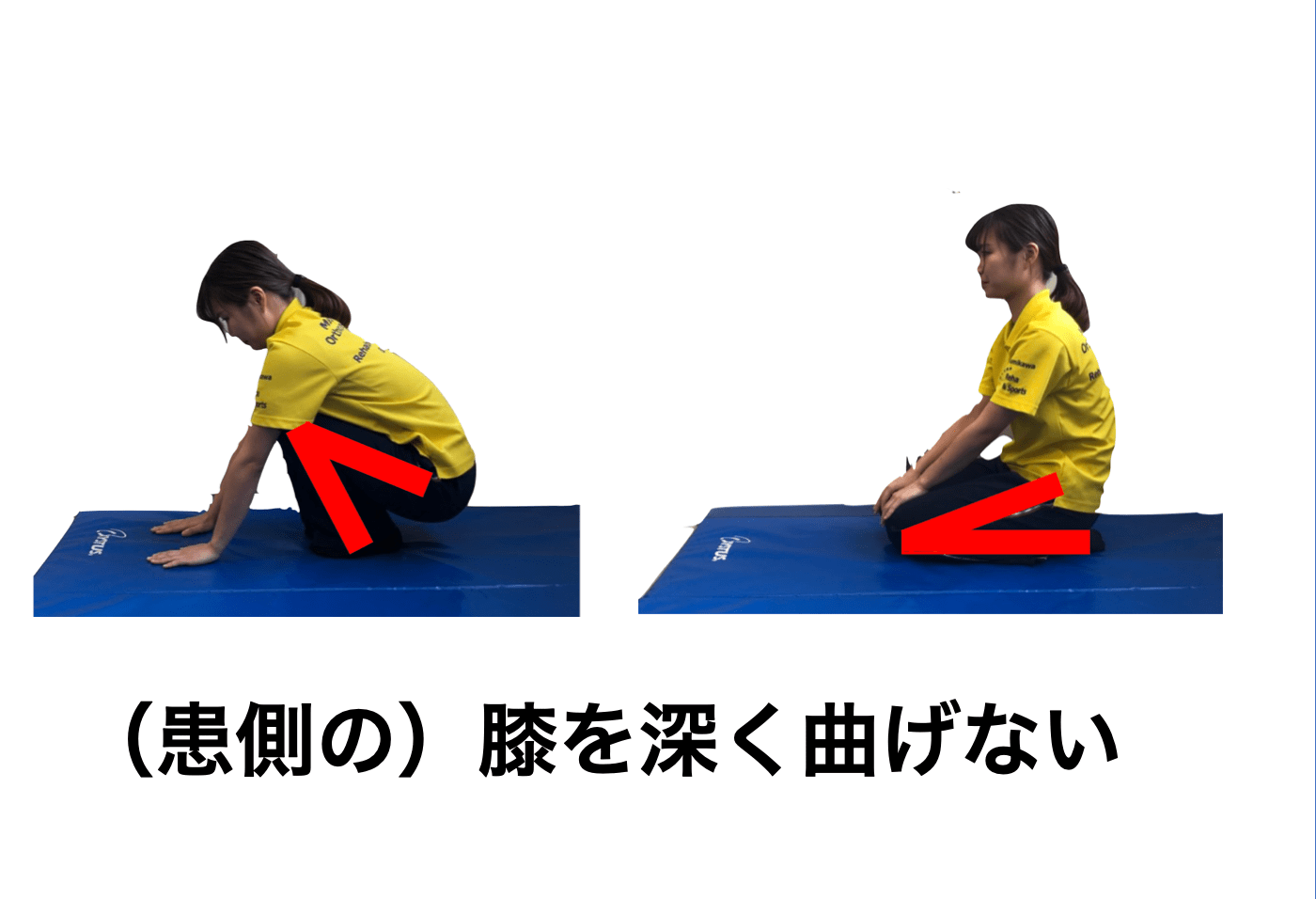 新着・イベント情報｜お知らせ｜【南川コラム】半月板損傷/手術後のリハビリを紹介!｜医療法人 南川整形外科病院(救急告示)