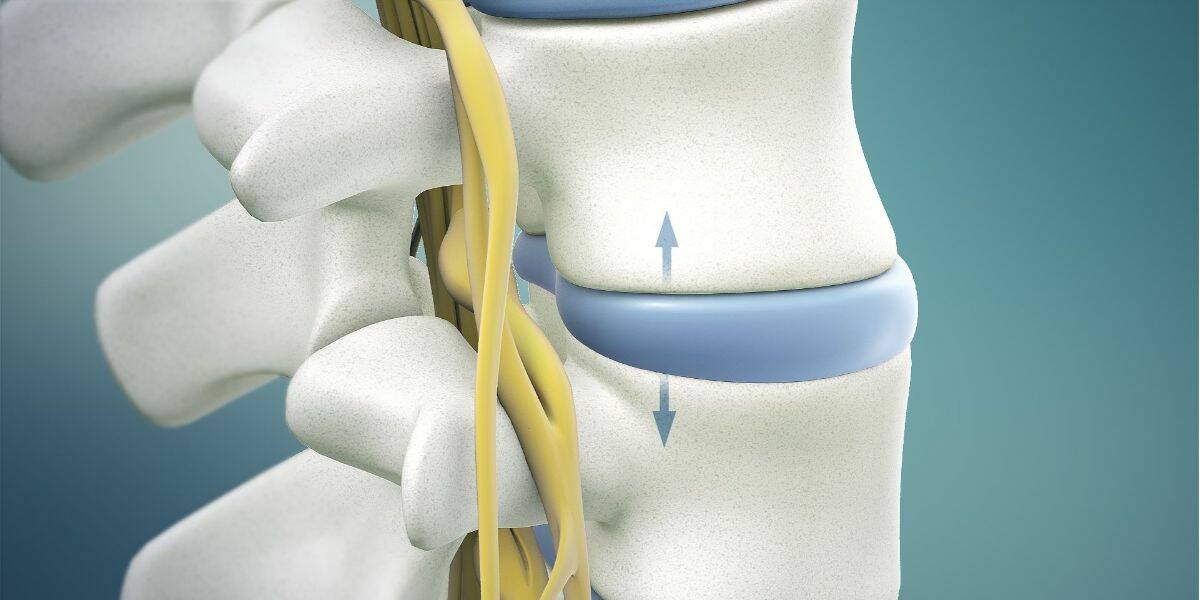 Spinal with Traction vs Inversion Tables