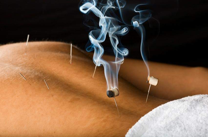 Authentic TCM & Five Element Acupuncture Near Me