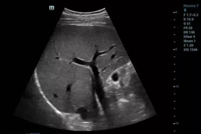 Mindray to Showcase LeadingEdge Ultrasound Solutions at Vascular