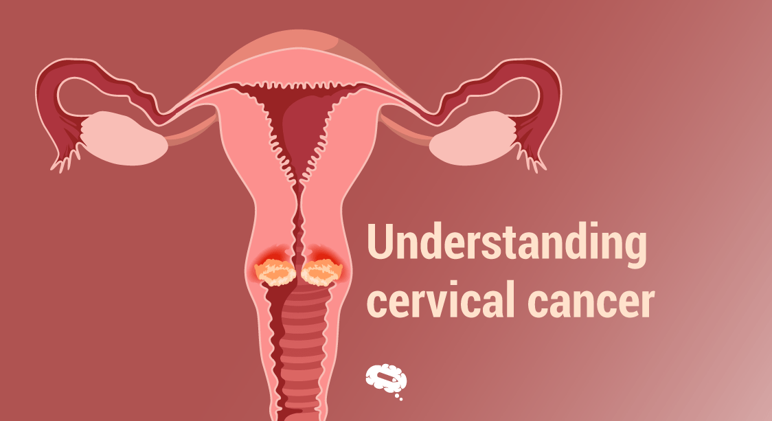 What Causes Cervical Cancer