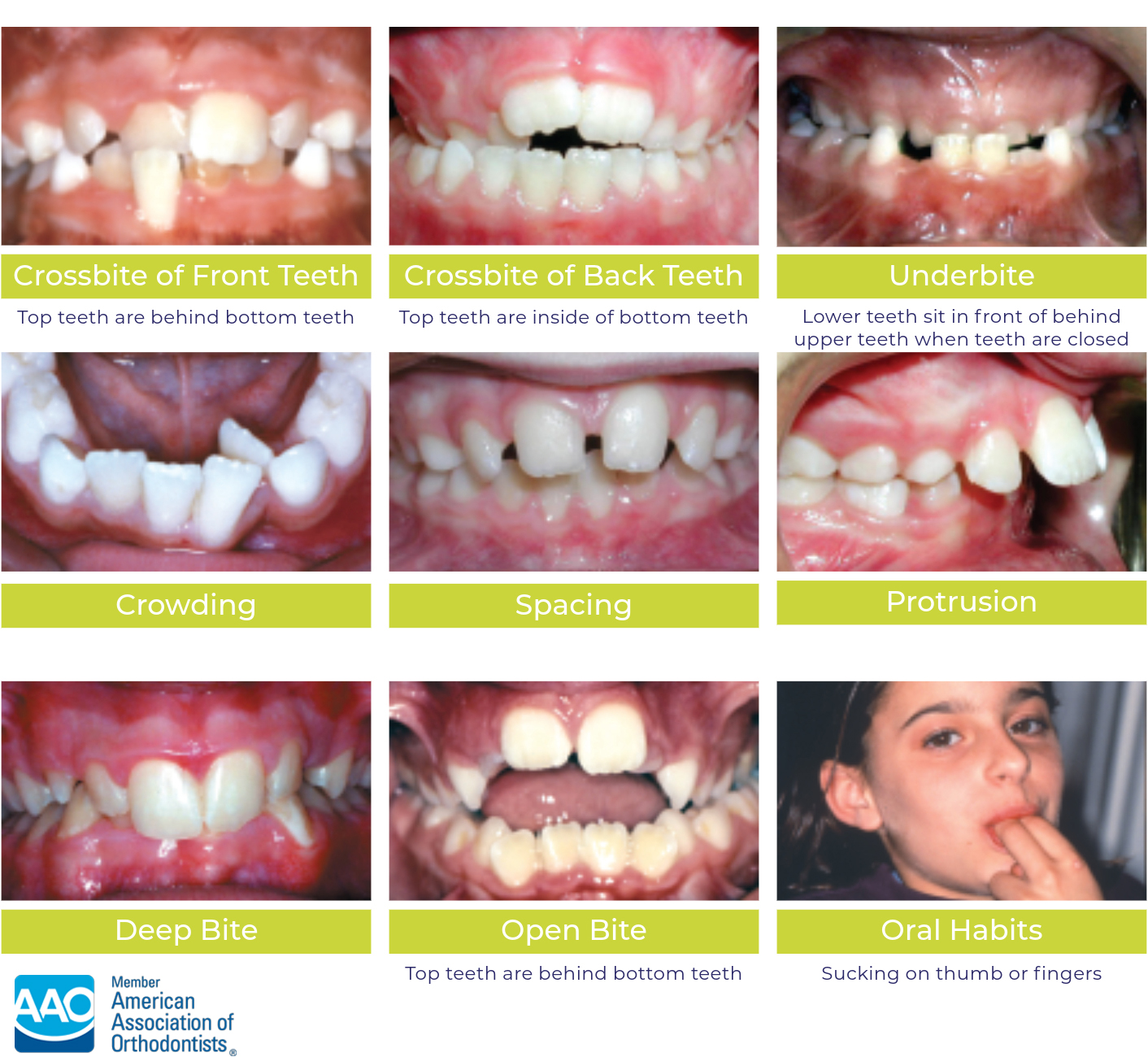 Kids Club Orthodontist Minot ND Invisalign Braces Prestwich