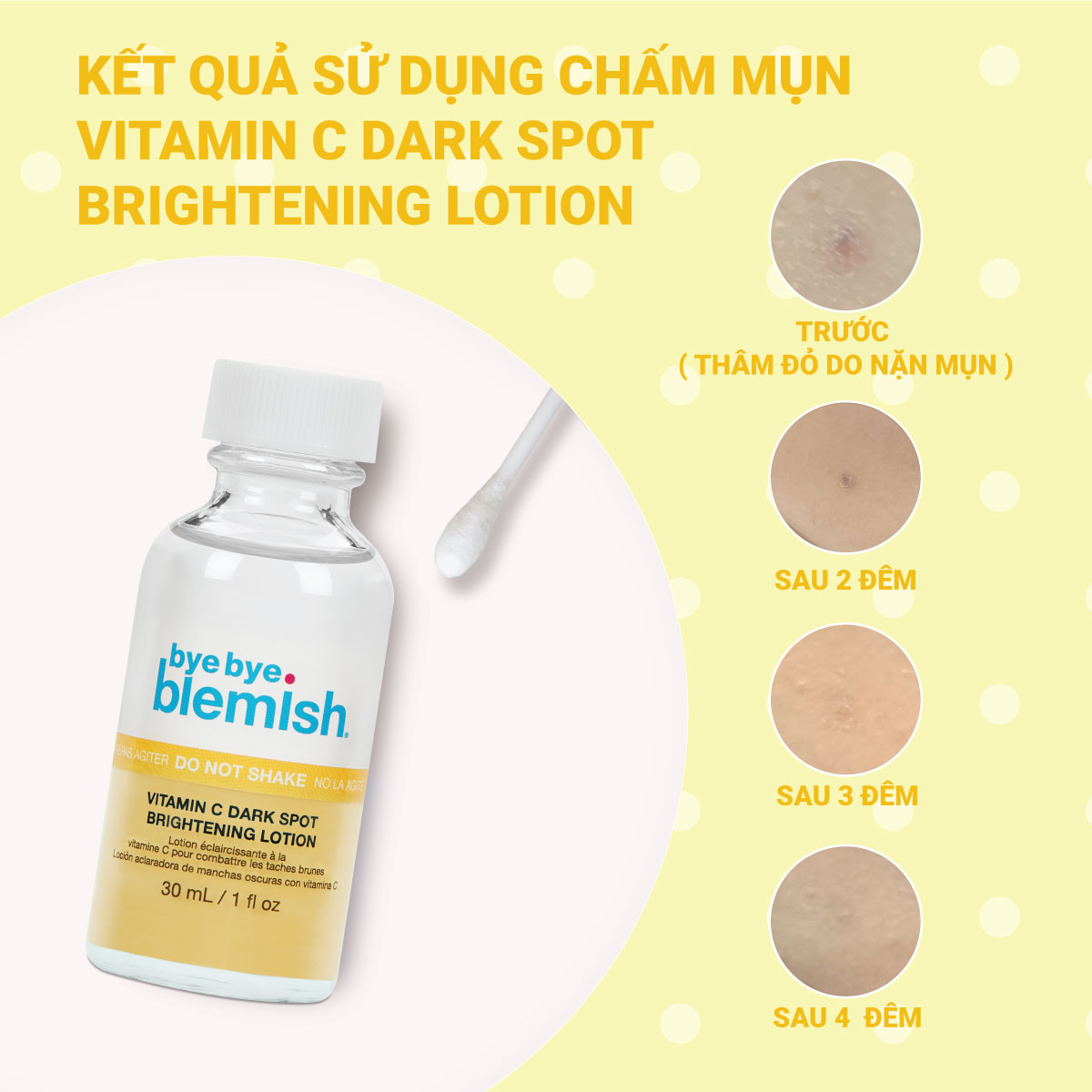 Chấm Mụn Bye Bye Blemish Vitamin C Dark Spot Brightening Lotion 30ml