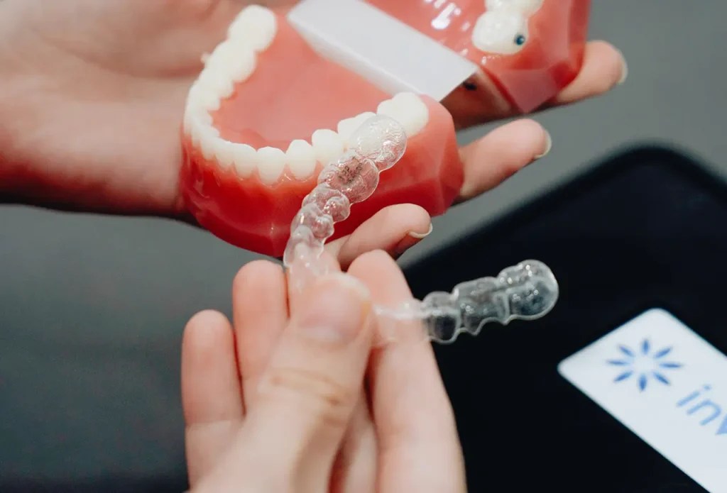 Is Invisalign Faster than Braces Gold+ Invisalign Dentist