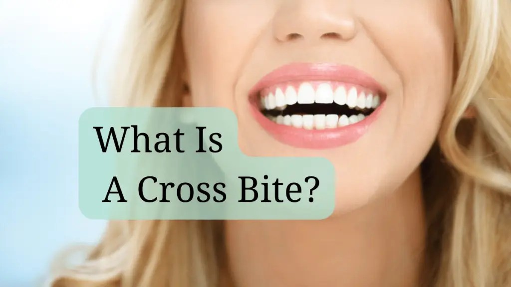 What is a Crossbite? Mint Leaf Dentistry