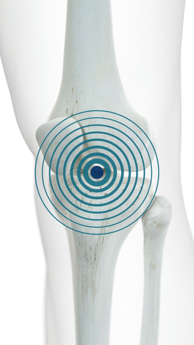 Prolozone Therapy Natural, OpiodFree Pain Relief for Back & Joint Pain