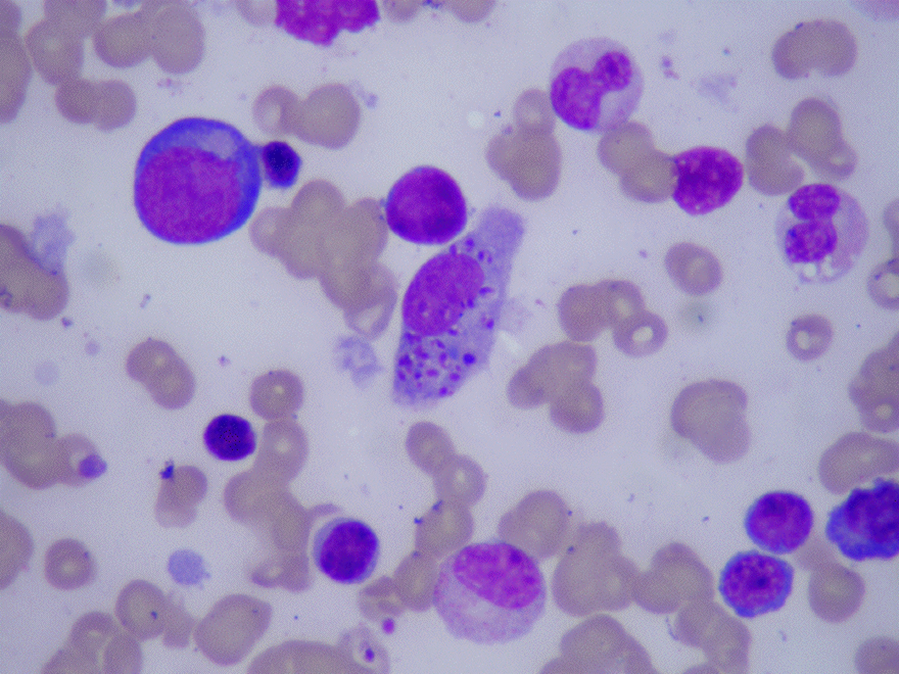 Clinical Vignette 3 Miphidic