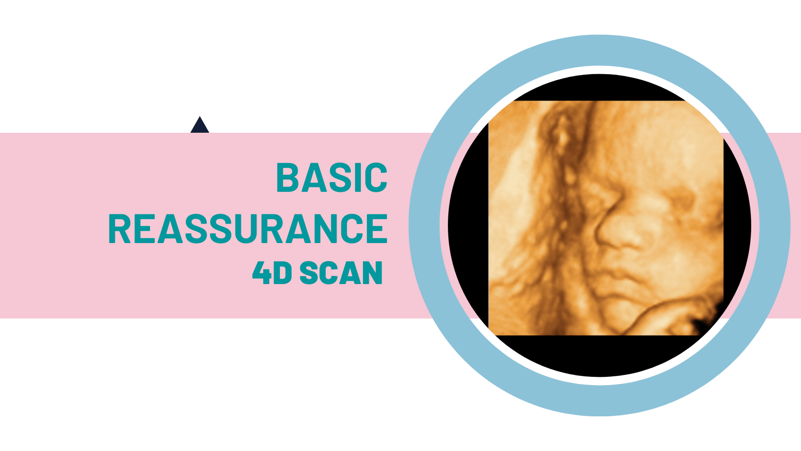 2D/3D/4D Baby Scan Centre Baby Scan UK Gender Scans