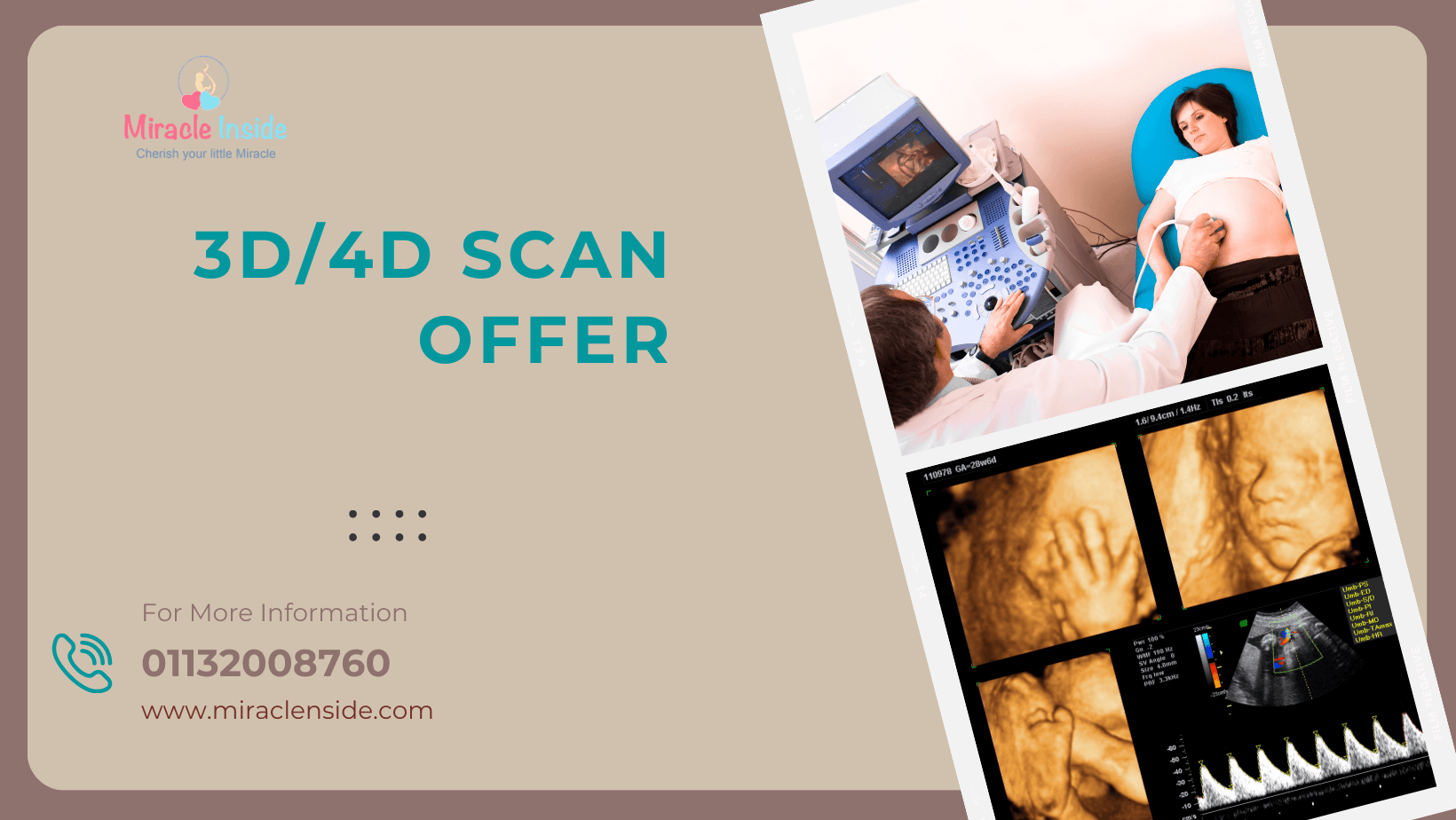 2D/3D/4D Baby Scan Centre Baby Scan UK Gender Scans