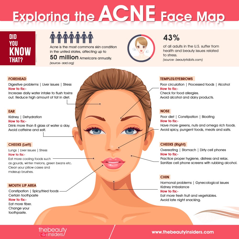 Acne Face Map Know what does acne reveal about your health by Mia