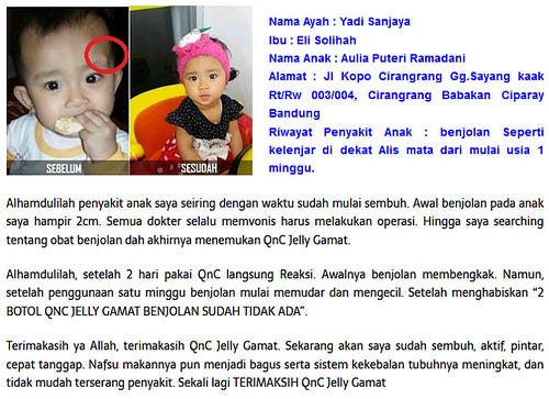 Cara Menghilangkan Uci Uci Secara Tradisional