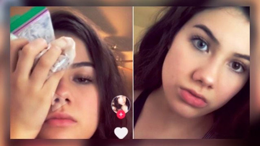 Dangerous Bright Eye Challenge on TikTok that has viral thanks
