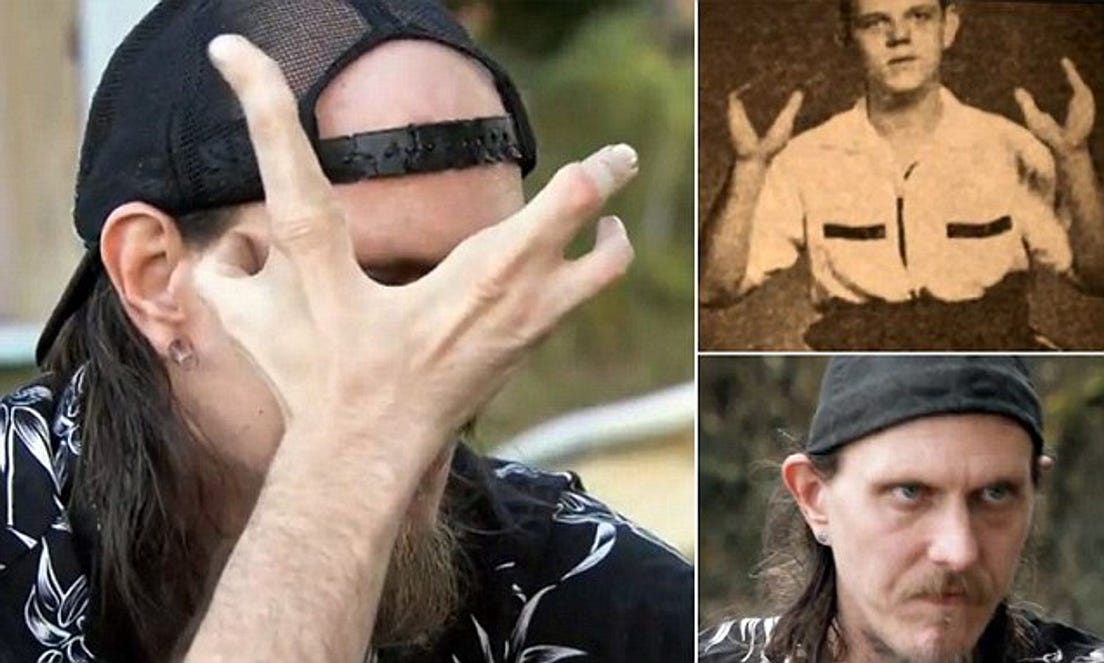 The Killer Lobster Boy Who was Hated By the Masses by 👑