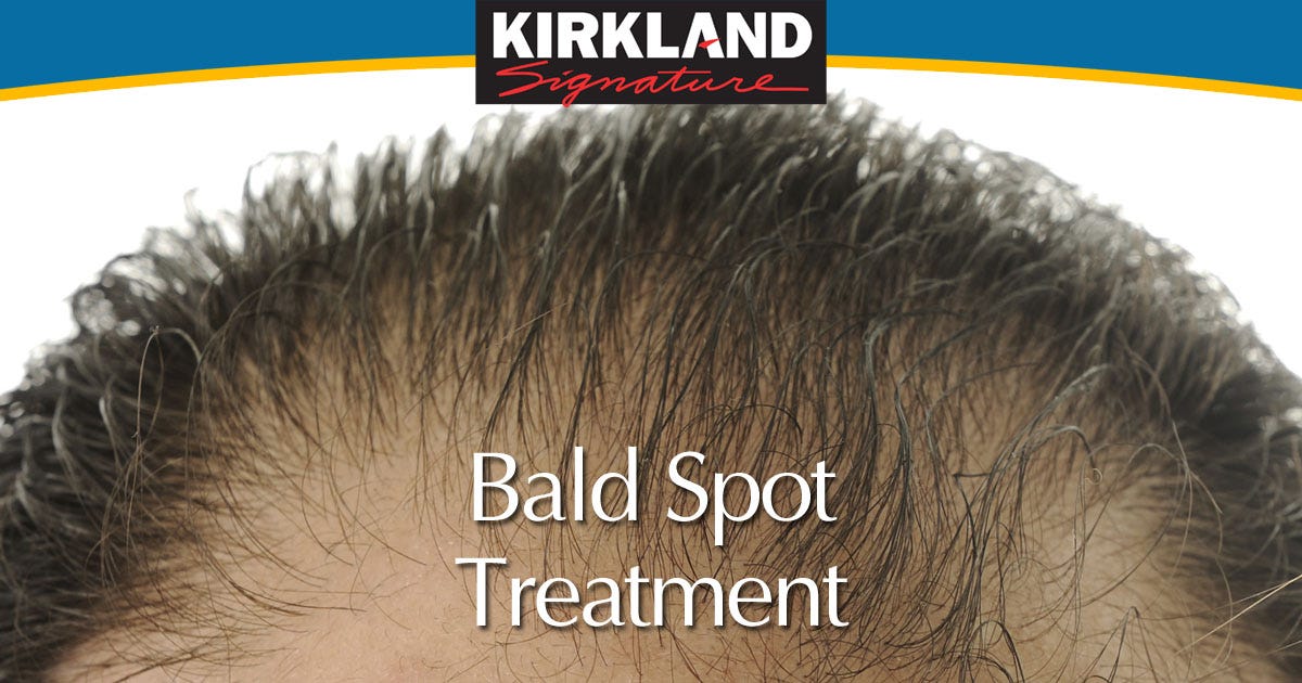 Bald Spot Treatment Minoxidil UK Medium