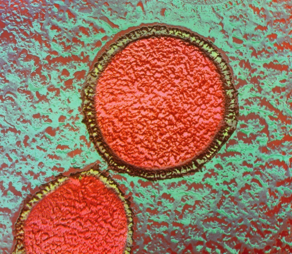 New study on Asgard archaea suggests a possible clue to eukaryotic