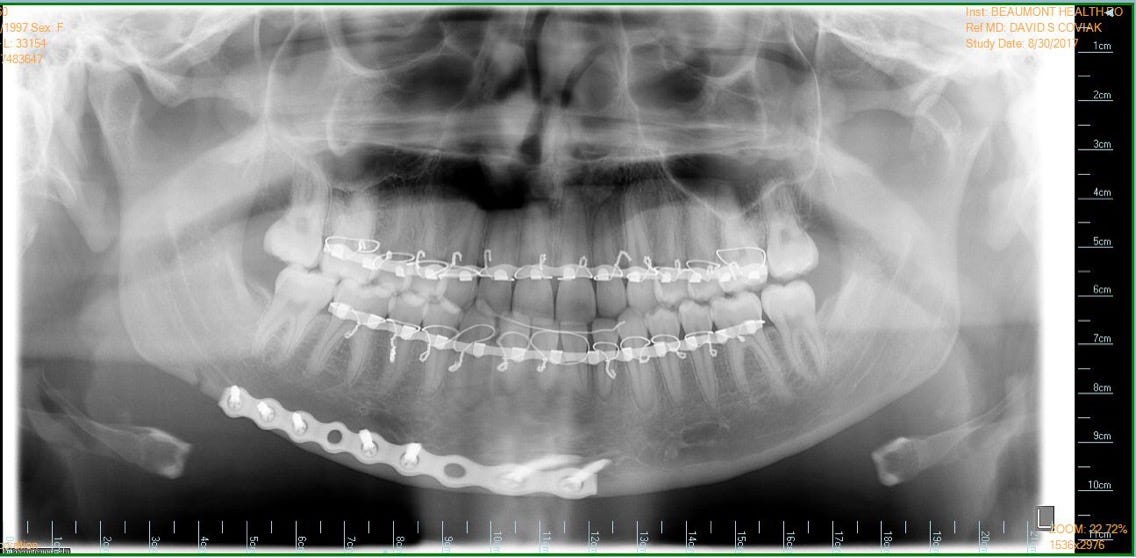 How to UnBreak Your Jaw Claire Nord Medium