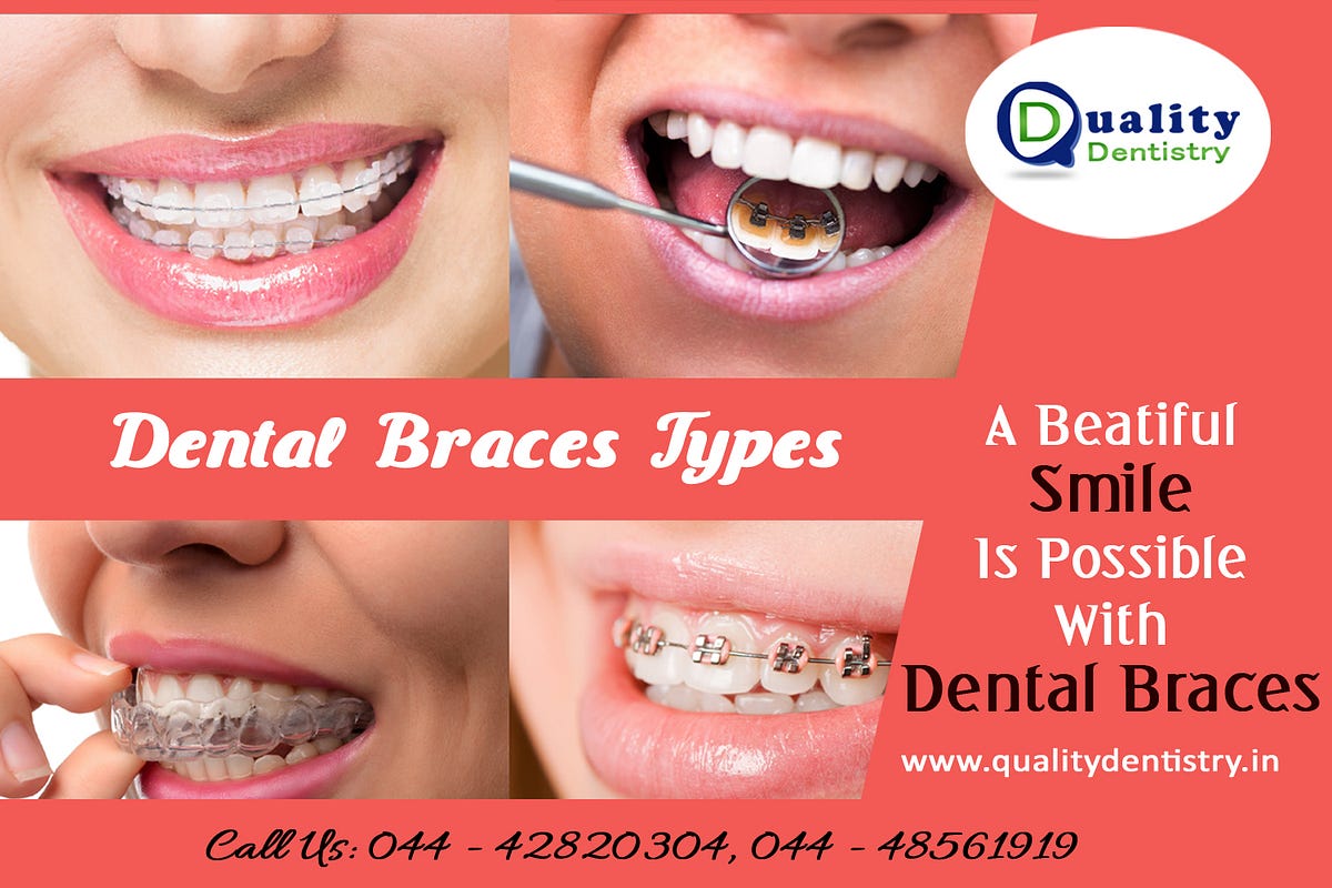 BENEFITS OF WEARING INVISALIGN BRACE by vangarsmith Medium