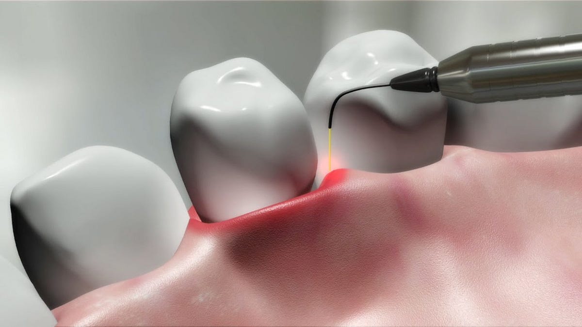 Spice up with a confident smile through the HCF dentist complete dental