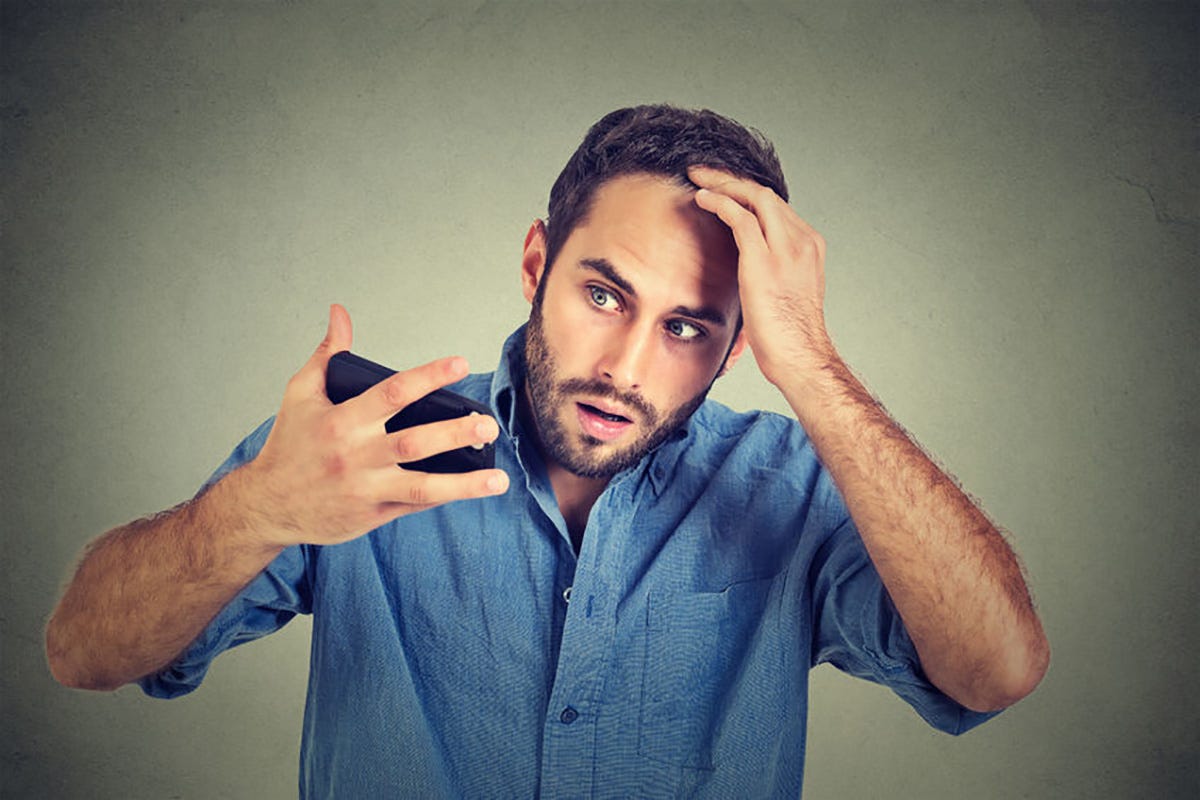 6 Ways To Stop A Receding Hairline by Drew Williams Medium 6 Ways To Stop A Receding Hairline by Drew Williams Medium