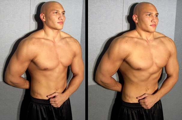 Pectus Clinic Medium