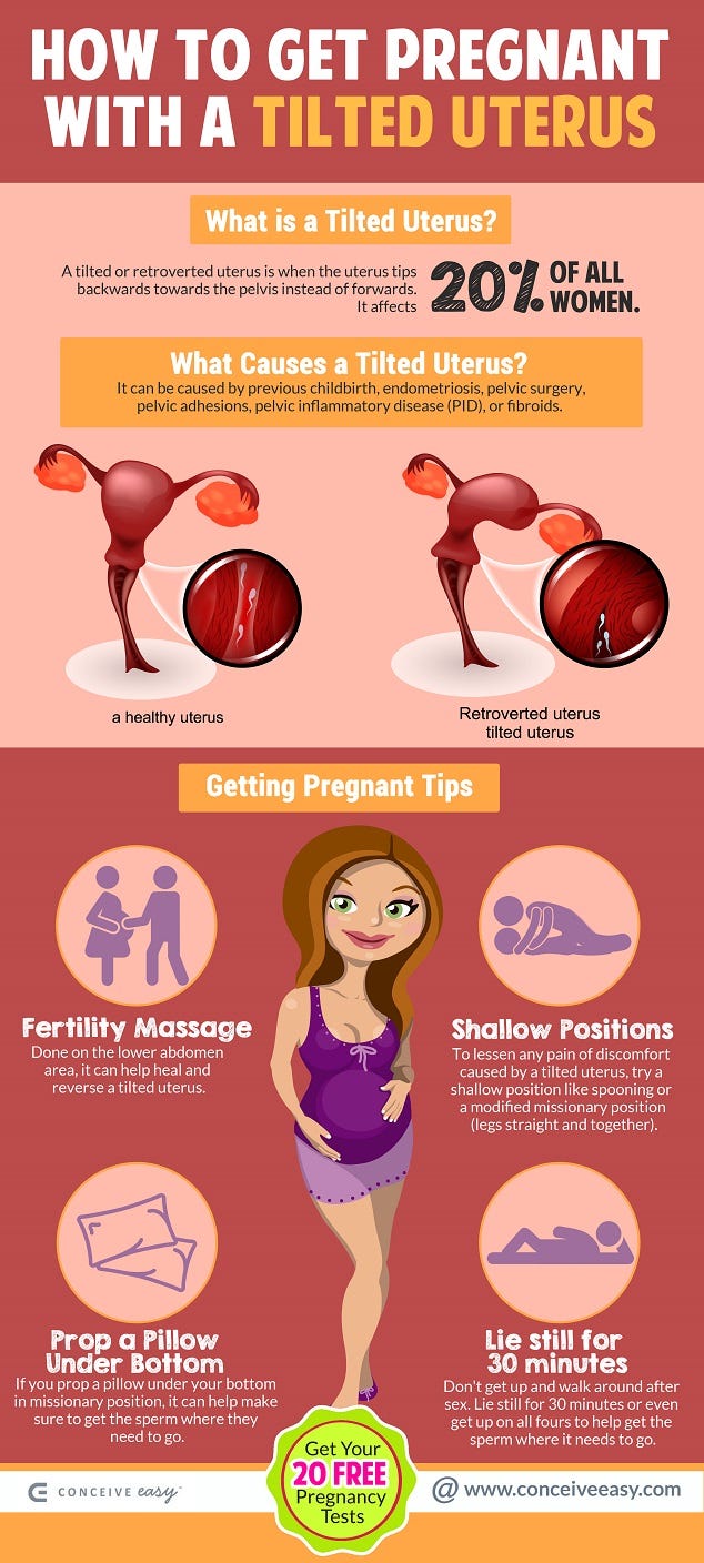 How to Get Pregnant with a Retroverted Uterus Infographic by Conceive