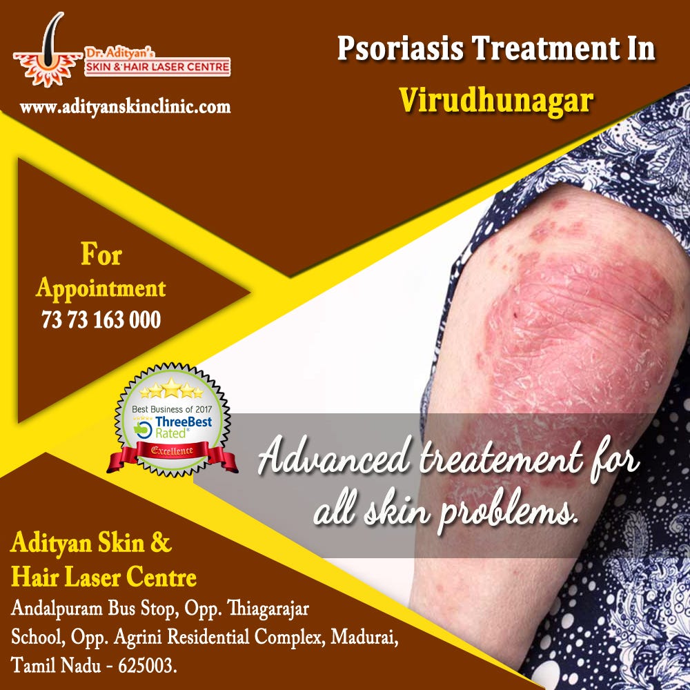 How Do You Know If You Have Psoriasis? by Serin Max Medium