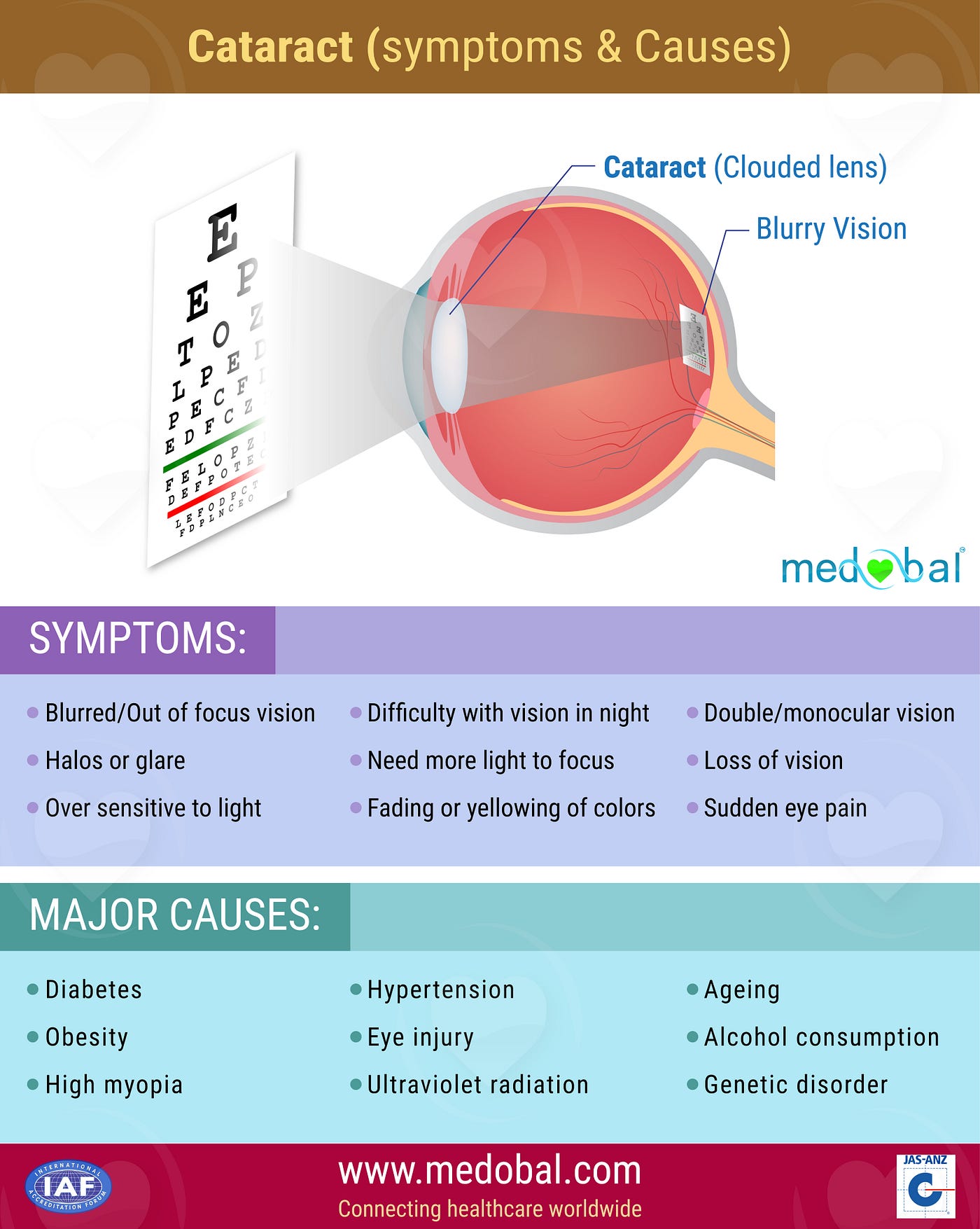 Cataract (Symptoms & Causes). Cataracts are the cause of half of… by