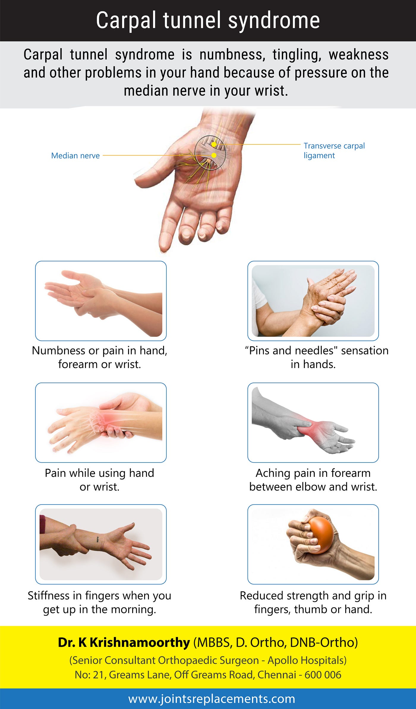 Carpal tunnel Syndrome. A numbness and tingling in the hand and… by