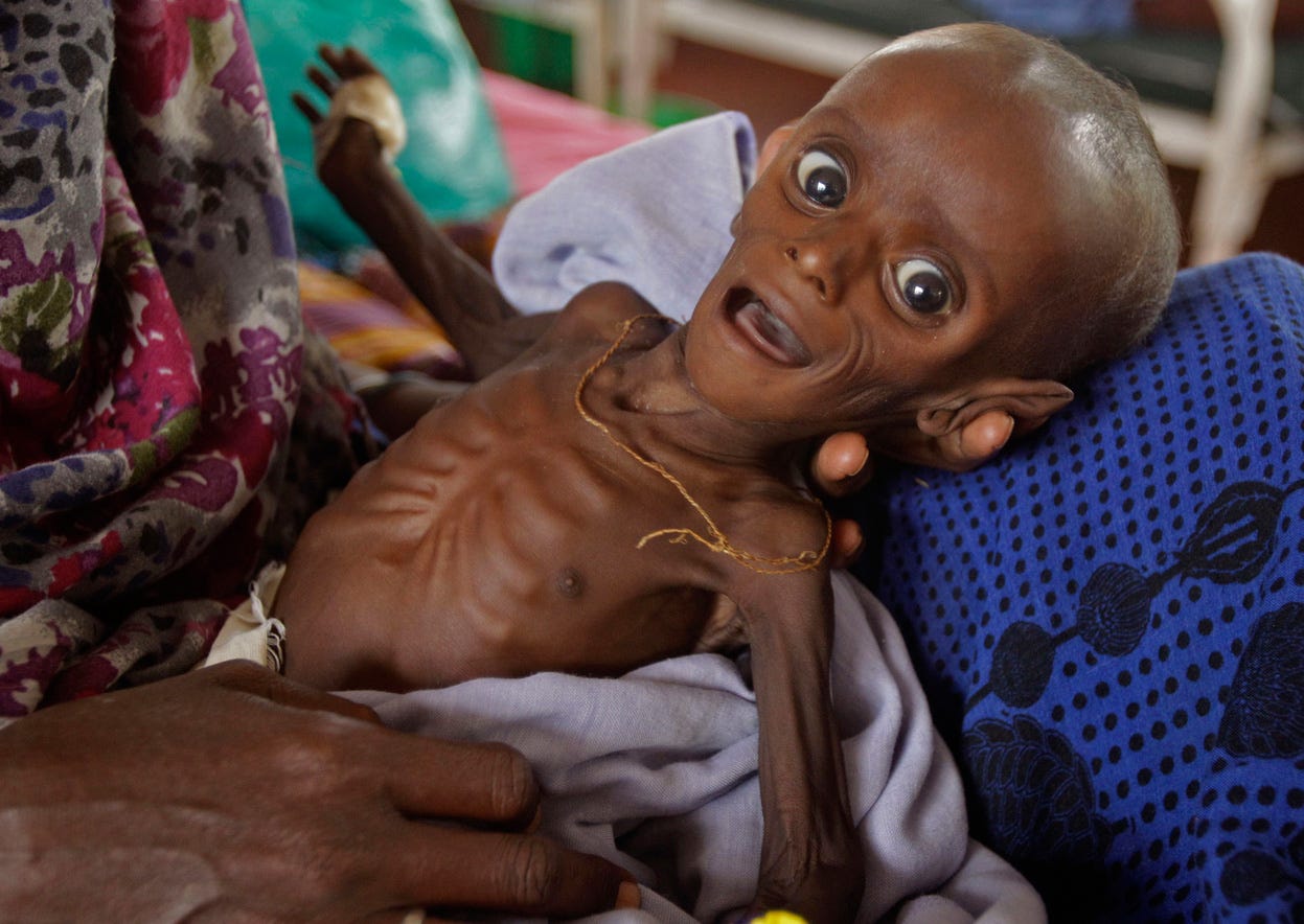 We did not find results for: The Dirty Reason Why Starving Children Are The Face Of Africa In The Media By The Pan African Alliance Medium