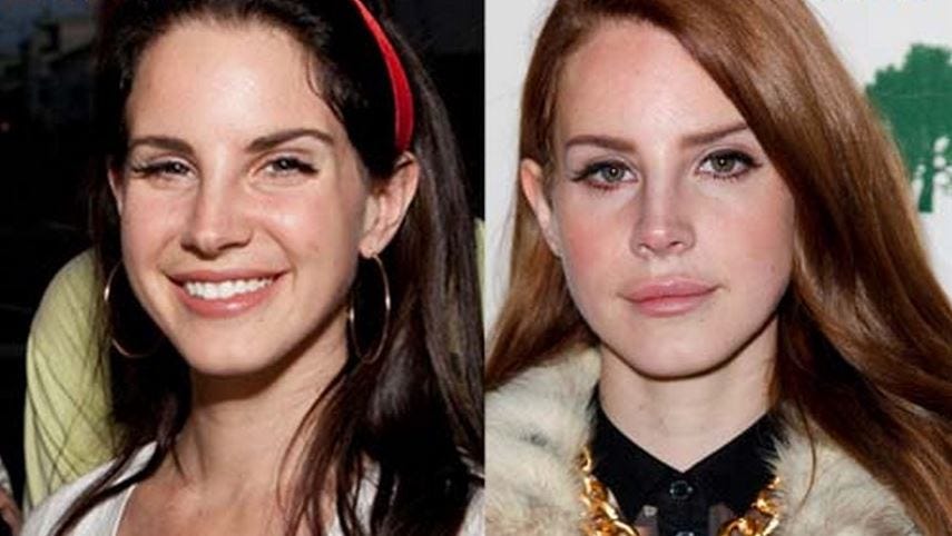 LANA DEL REY PLASTIC INSIGHT. Lana Del Ray is an American singer… by