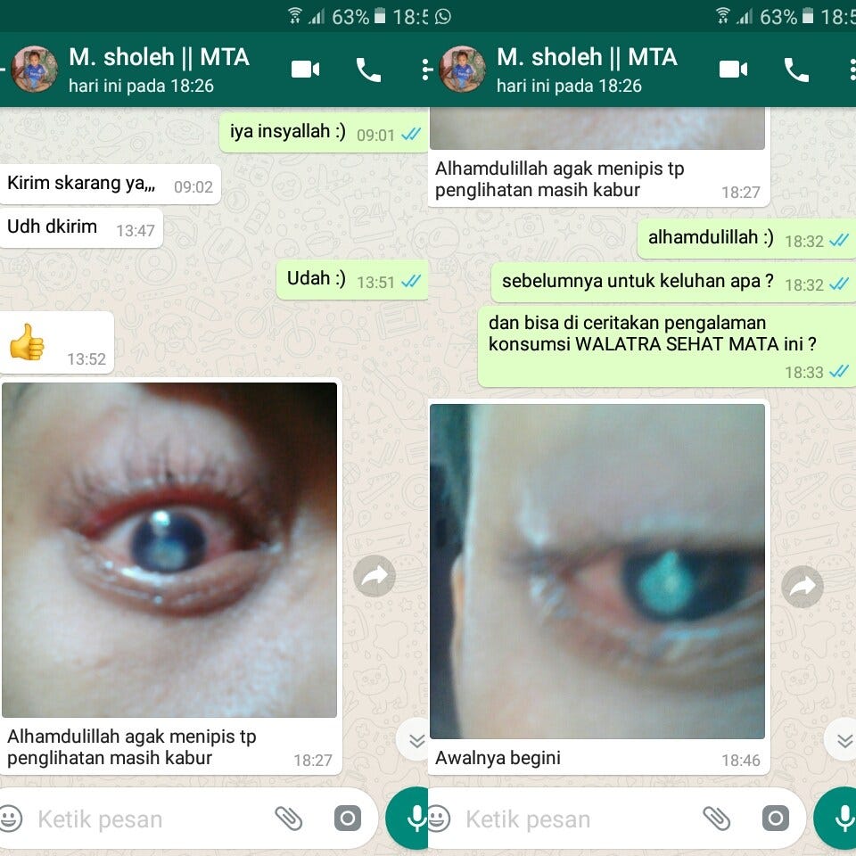 Ada Bintik Putih Di Kelopak Mata Bagian Dalam Berbagai Mata