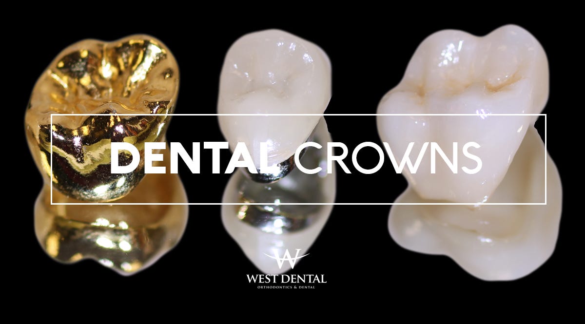 Types and benefits of Dental Crowns by West Dental Medium