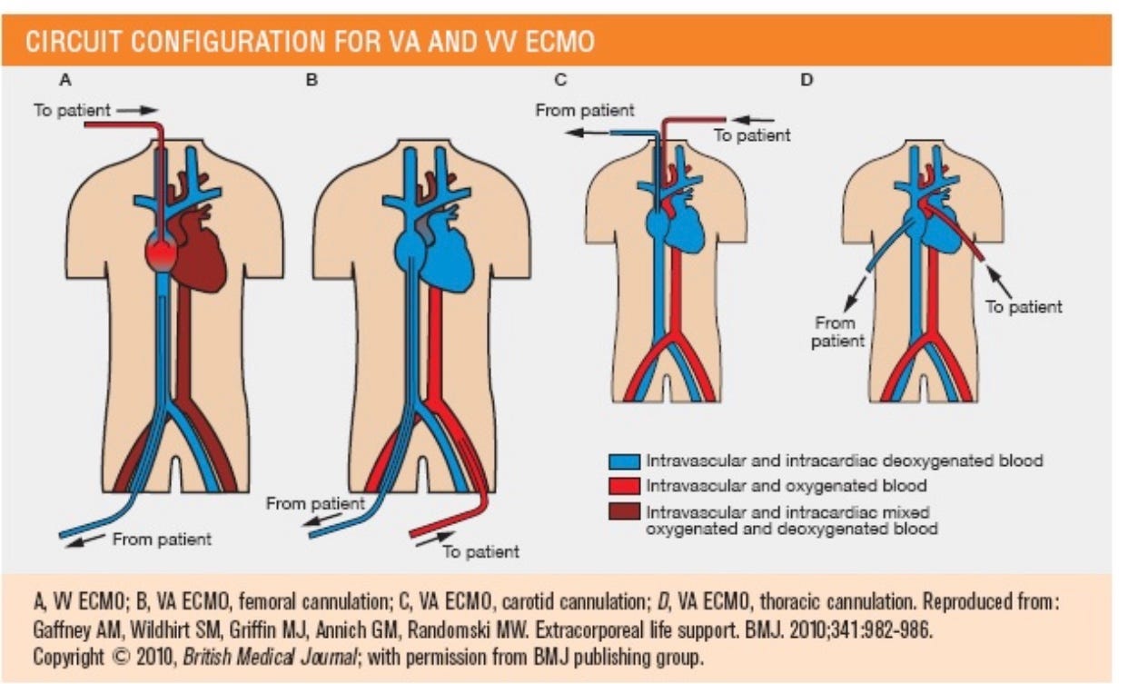 Yes, The EOLIA Trial Was Technically Negative But… Dr. Hesham A