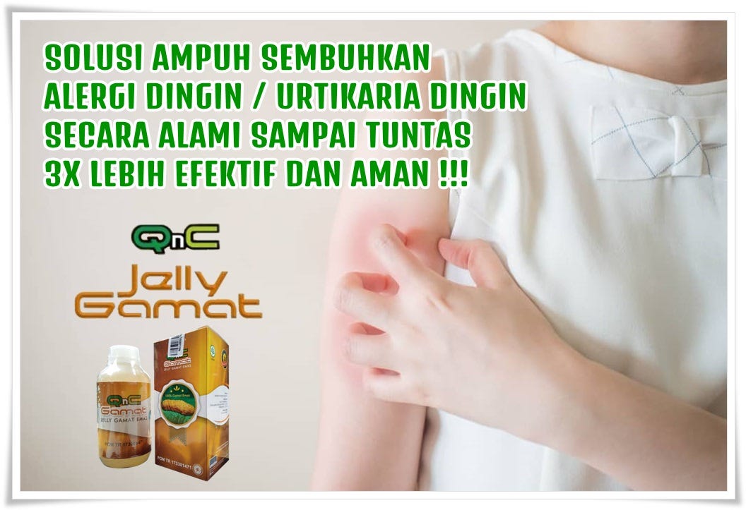 Cara Menghilangkan Alergi Dingin Gatal