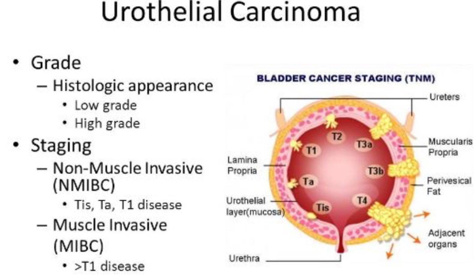 How Cancer Changed My Life. Sarah Andrew by Sarah Andrew Medium