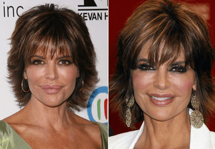 Lisa Rinna Plastic Surgery Insight | By View Plastic Surgery | Medium